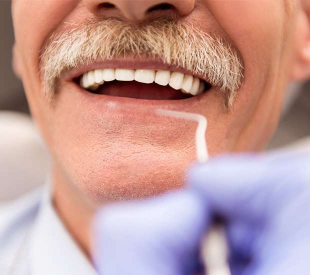 Plano Adjusting to New Dentures