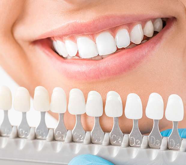 Plano Cosmetic Dentist
