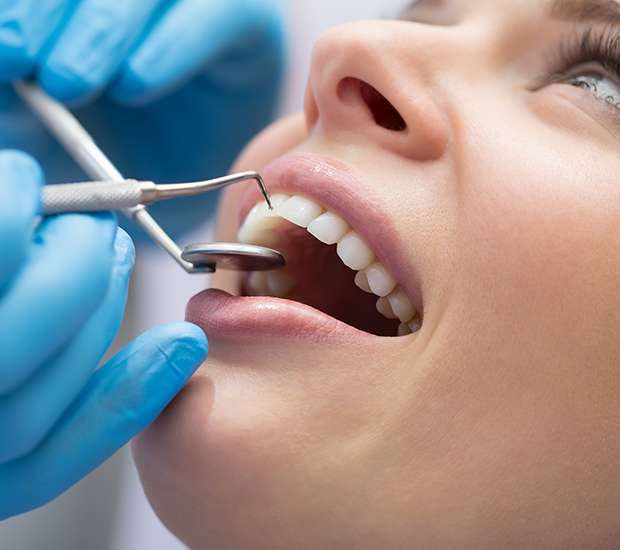 Plano Dental Bonding