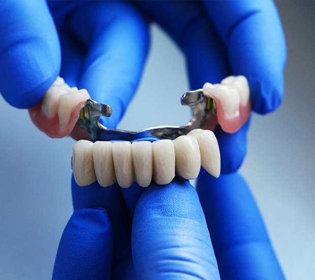Plano Dental Bridges