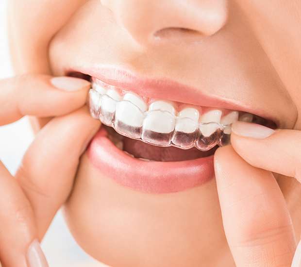Plano Does Invisalign Really Work