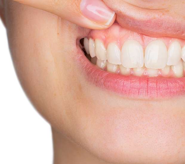 Plano Gum Disease