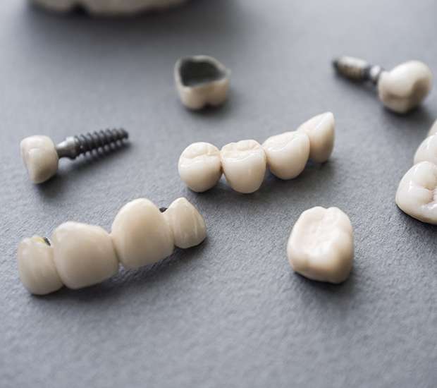 Plano The Difference Between Dental Implants and Mini Dental Implants