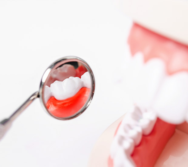 Plano Interactive Periodontal Probing
